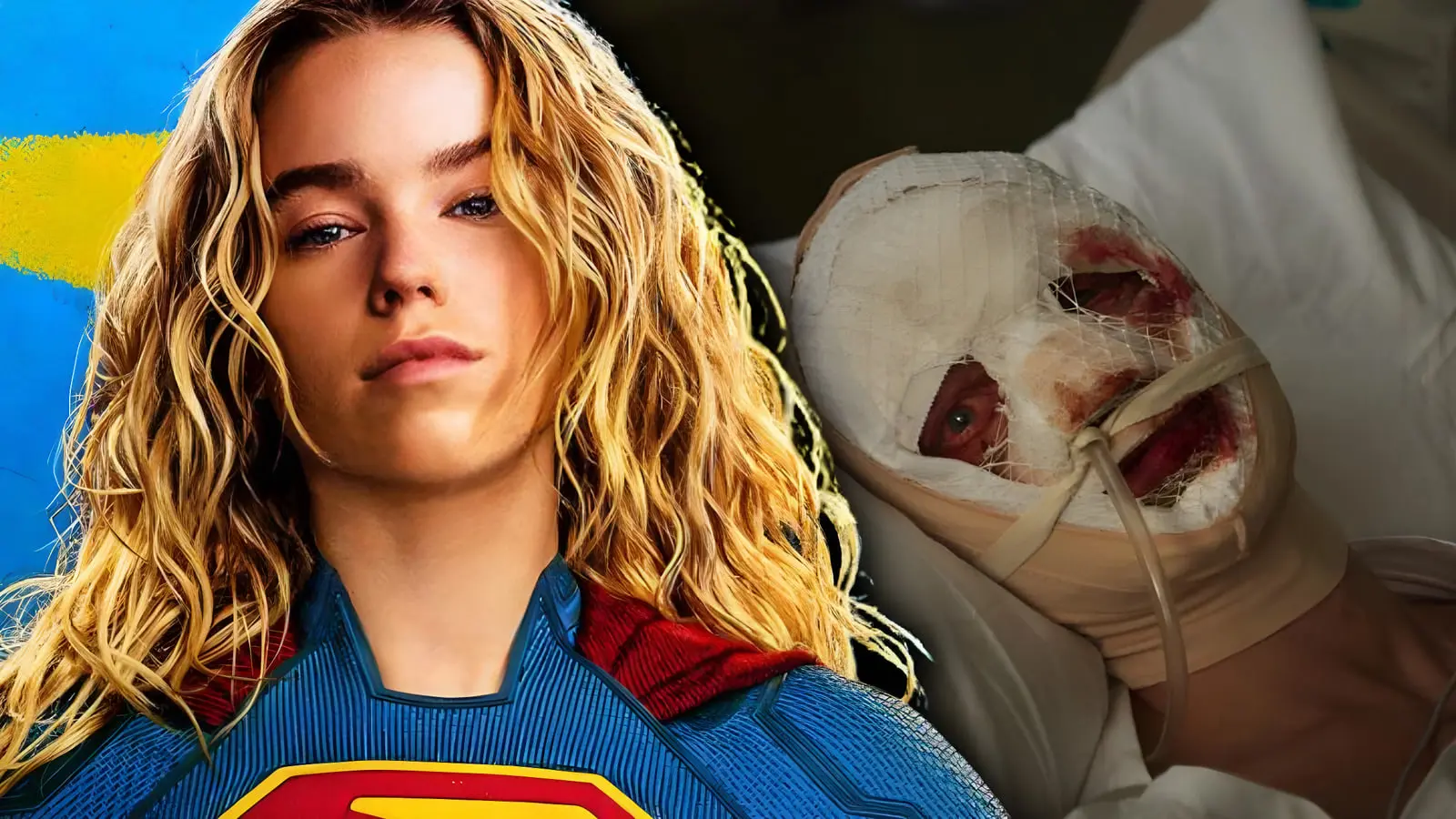 چهره سوپرگرل (Supergirl) در کنار شخصیت آسیب‌دیده در فیلم کلی‌فیس (Clayface)